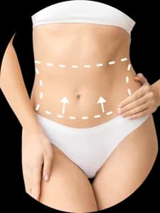 Abdominoplastika